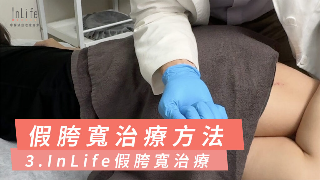 假胯寬治療方法3. InLife假胯寬治療